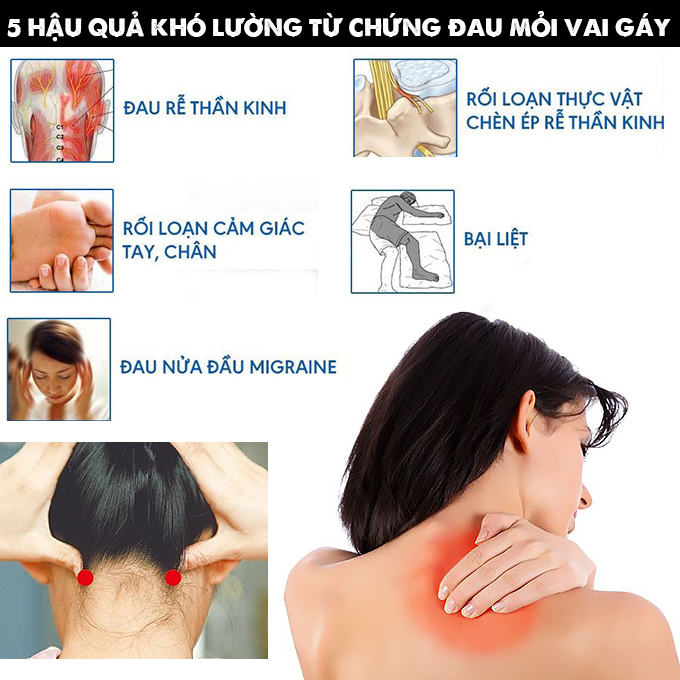 cach-xoa-bop-bam-huyet-chua-dau-lung-ngay-tai-nha-3