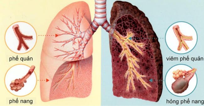 Một số huyệt vị chúng ta có thể xoa bấm giúp cải thiện phổi