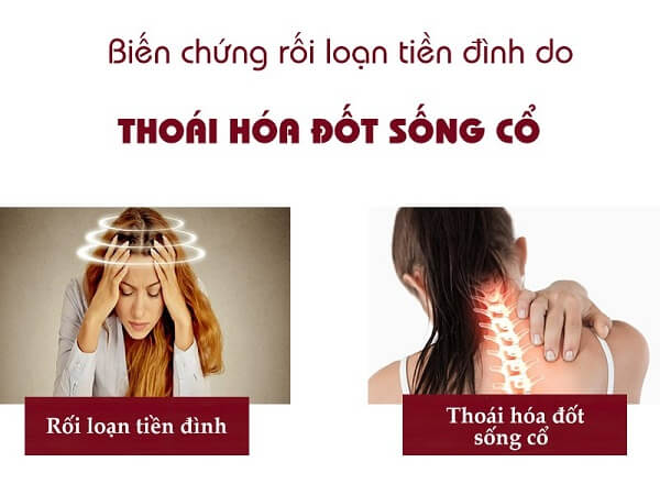 roi-loan-tien-dinh-do-thoai-hoa-dot-song-co-2
